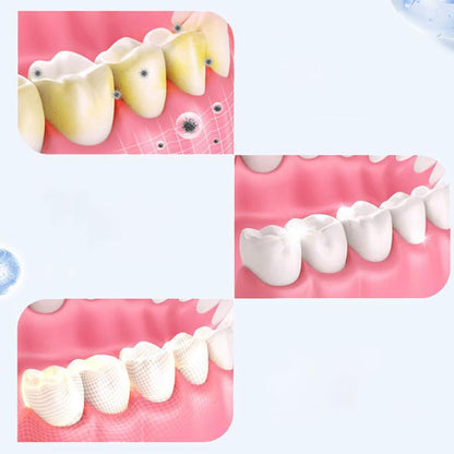 Kit de clareamento dental com moldeira para deixar os dentes mais brancos da Vapto